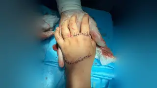 “Пальцы не двигаются, дочь больше не улыбается“: ребенку покалечило руку в детском центре Актобе