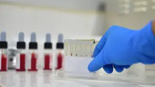 Опасную инфекцию диагностировали у двух жителей Кызылординской области