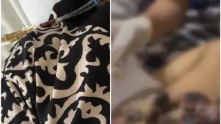 “Сказали, что грыжа, а оказался рак“. Астанчанка пожаловалась на халатность врачей