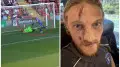 Вратарь “расколол“ голову соперника во время матча: видео