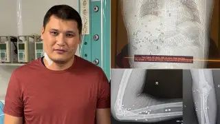 Покушение на замакима: Руслана Берденова готовят к операции