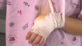5-летняя девочка потеряла палец на аттракционе в ТРЦ