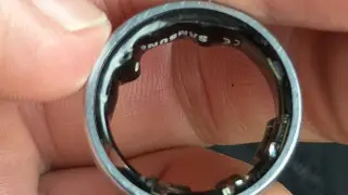 “Чуть не лишился пальца“: айтишник попал в больницу из-за умного кольца Samsung