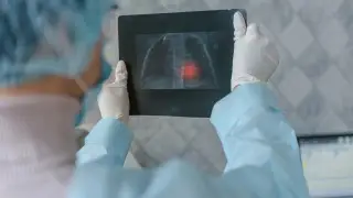 У студентов крупных вузов в Астане и Алматы нашли туберкулёз