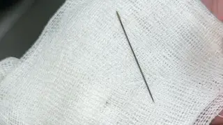 Иглу обнаружили врачи в теле 8-месячного ребёнка в Туркестане