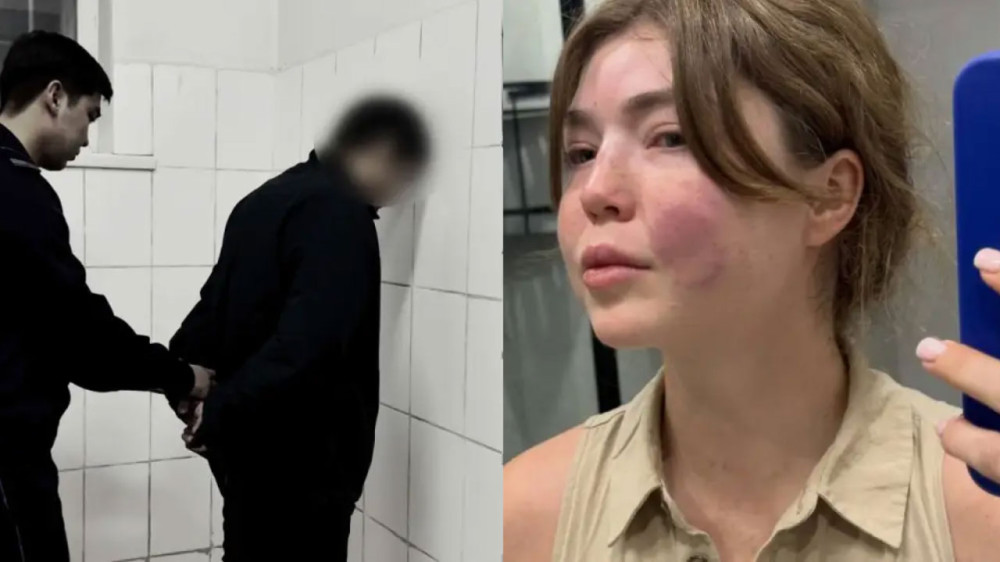 Как он уехал во время следствия? Алматинца разыскивают по делу об избиении и повторном сталкинге