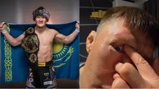 “Больше не буду драться“ - Жалгас Жумагулов высказался о карьере после скандального боя
