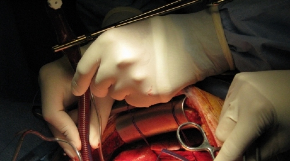Donors requried for first heart and liver transplantations in Kazakhstan