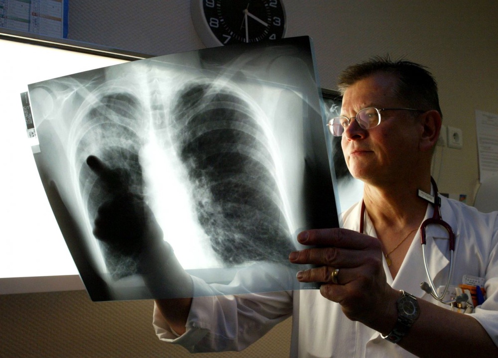 Eight sick with Legionnaires' Disease at Spanish hotel 