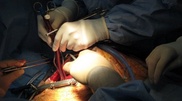 Kazakhstan doctors transplanted donor heart for the first time