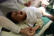 Fewer circumcisions could cost the US billions: study 
