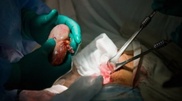 First donor kidney transplantation made in South Kazakhstan
