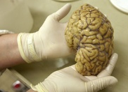 Personality traits probed in high-res brain scans 