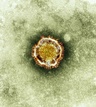 SARS-like virus seems to cause deep lung infection 