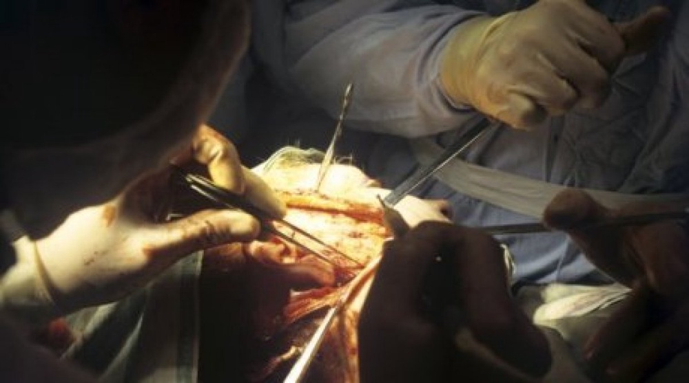Kazakhstan microsurgeons tap into face transplantation surgeries