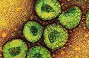 SARS-like virus in Saudi has killed 15: minister 
