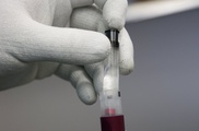 No risk of pandemic yet from MERS virus: scientists 