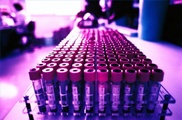 New treatment could help those with Crohn's, colitis: study 