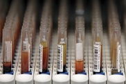 Gene map helps trace spread of MERS virus