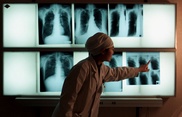 Japanese doctor with TB saw over 600 patients: official
