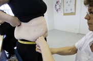 Obesity linked to early onset of puberty in US girls
