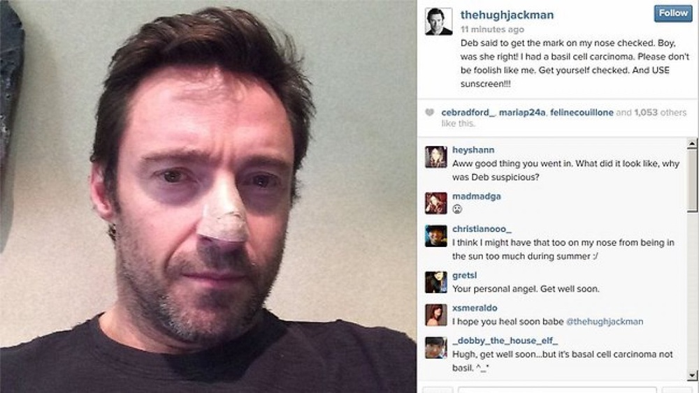 Hugh Jackman reveals treated for skin cancer