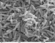 Jar of preserved intestine solves 1800s cholera mystery