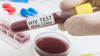 Second patient cured of HIV in Germany