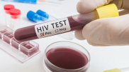 Second patient cured of HIV in Germany