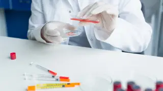 Risk of mpox in Kazakhstan commented by the Ministry of Healthcare