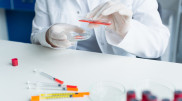 Risk of mpox in Kazakhstan commented by the Ministry of Healthcare