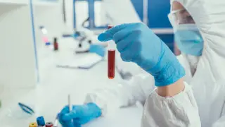 Anthrax outbreak in Almaty: four cases reported