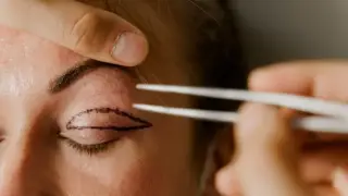 Kazakh woman unable to close her eyes after home surgery