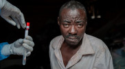 WHO approves first monkeypox vaccine