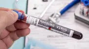Kazakhstan's chief sanitary doctor addresses Marburg virus outbreak