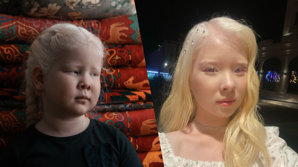 “Mom, I’m not afraid of the sun anymore”: how the albino sisters from Aktau live