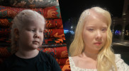“Mom, I’m not afraid of the sun anymore”: how the albino sisters from Aktau live