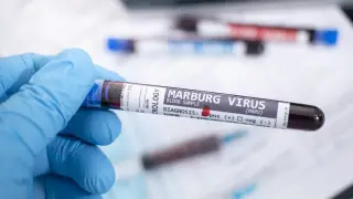 Chief sanitary doctor was asked about the Marburg virus outbreak in Kazakhstan