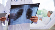 Doctor warned about atypical pneumonia symptoms