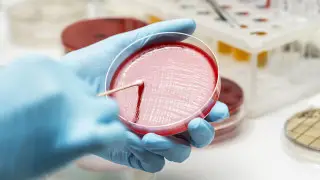 Anthrax in Kazakhstan: Ministry of Healthcare reported on the situation