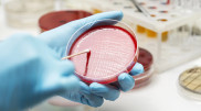 Anthrax in Kazakhstan: Ministry of Healthcare reported on the situation