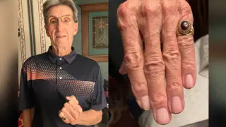 47-year-old lost ring returned to owner after discovery in Barbados