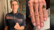 47-year-old lost ring returned to owner after discovery in Barbados