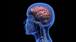 If a headache is a tumor or just a cold, neurologist explains