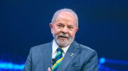 Brazilian President undergoes brain hemorrhage surgery