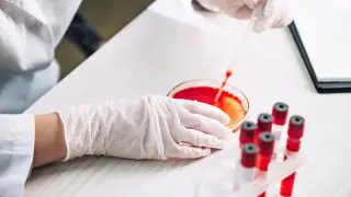 Unknown virus with severe symptoms has emerged in Russia – media