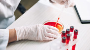 Unknown virus with severe symptoms has emerged in Russia – media