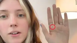 AI warns woman about possible cancer after palm reading request