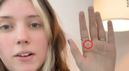 AI warns woman about possible cancer after palm reading request