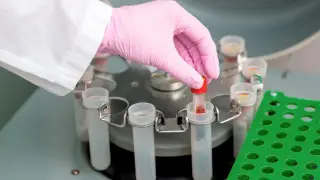 Eight cases of anthrax confirmed in Akmola region